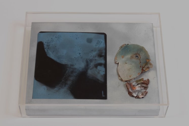 Bruce Conner Crying X-Ray