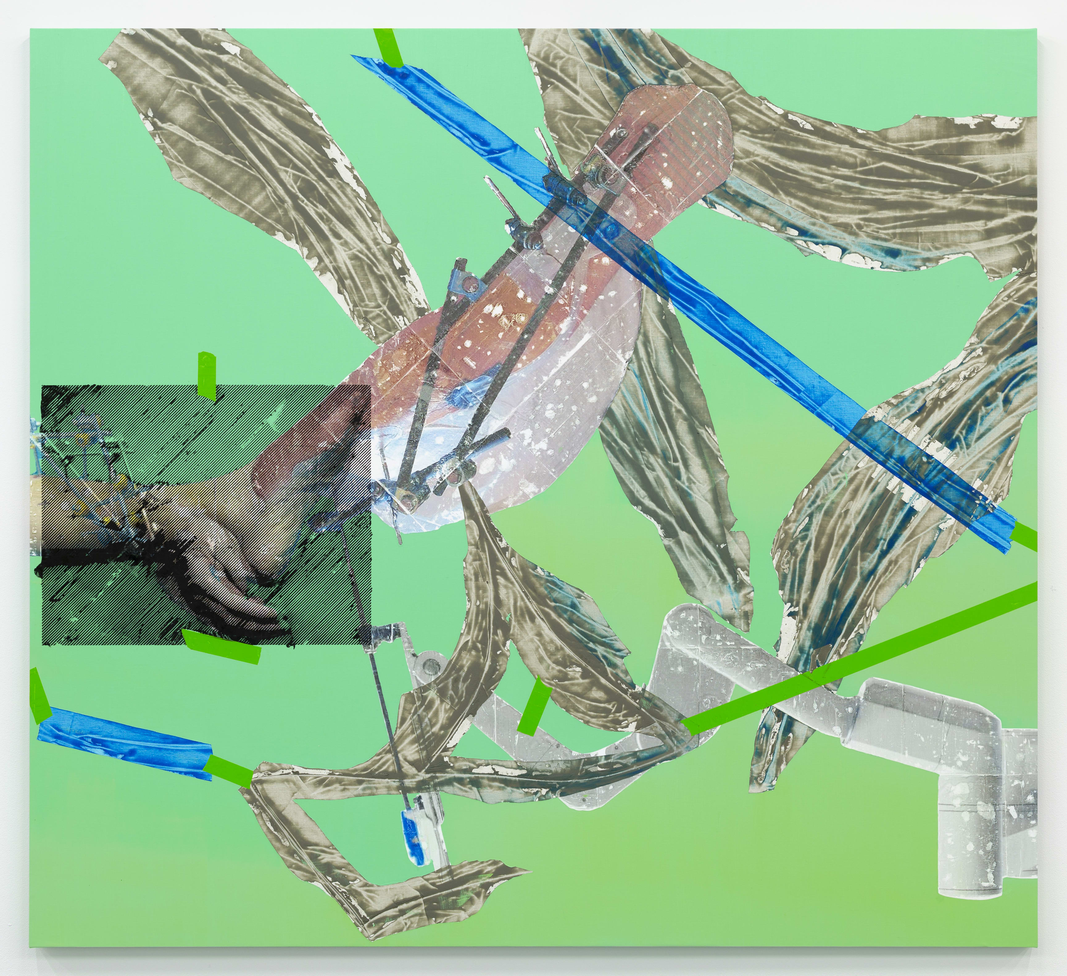 Temporary Composition (Hand Attached to Broken Leg)